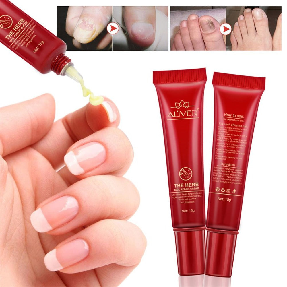 15G Natural Formula Nail Protector Skin Care Cream Nail Fungus Treatment Herb Nails Repair Cream Nail Care Tools - ebowsos