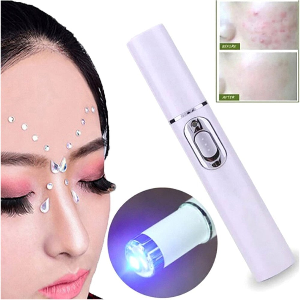 Acne Laser Pen Portable Wrinkle Removal Machine Durable Soft Scar Remover Device Blue Light Therapy Pen Massage Relax - ebowsos