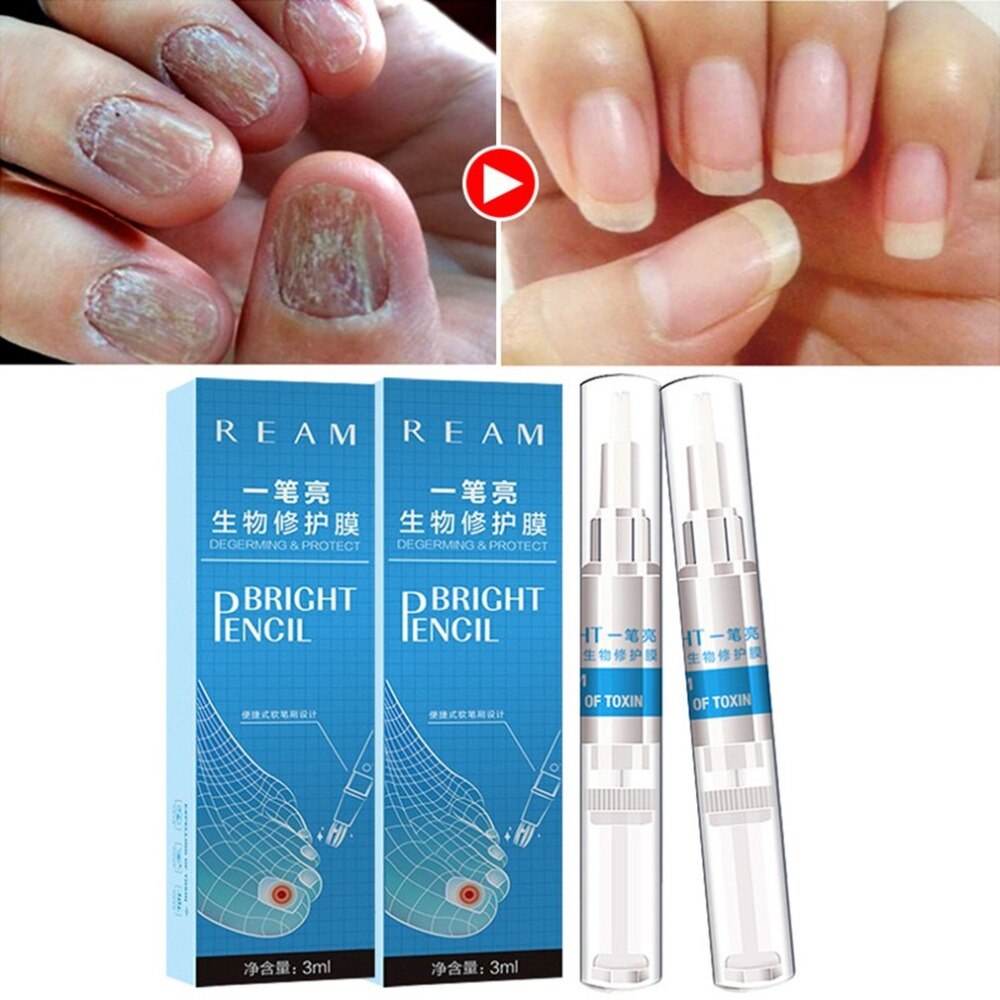 Creature repair film remove onychomycosis Nail care Manicure 1pcs - ebowsos