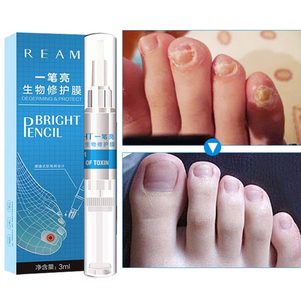 Creature repair film remove onychomycosis Nail care Manicure 1pcs - ebowsos