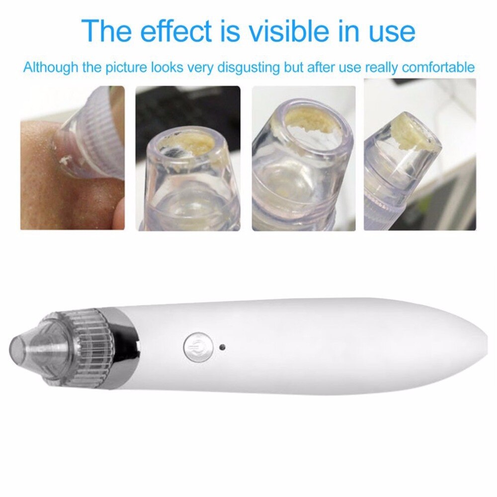 Portable Electric Blackhead Remover Facial Vacuum Pore Cleanser Face Skin Care Tool Spot Cleaner Instrument EU Plug - ebowsos