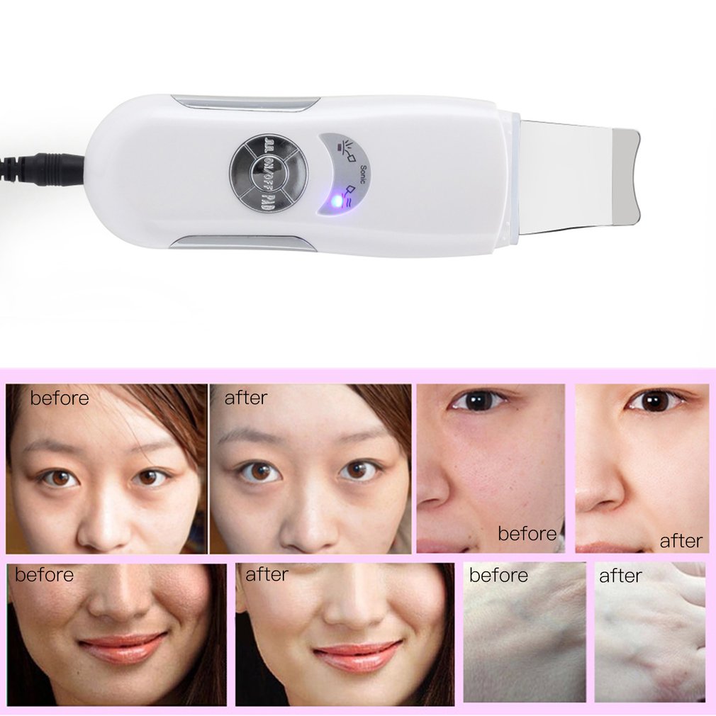 Skin Scrubber Ultrasonic Micro Electric Facial Dead Skin Black Head Remover Shovel Skin Household Beauty face - ebowsos